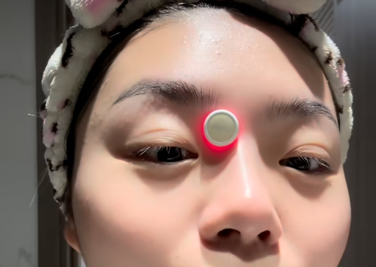 INNOVATIVE Small Button Electronic Acne Hydrocolloid Patch- 4 pieces