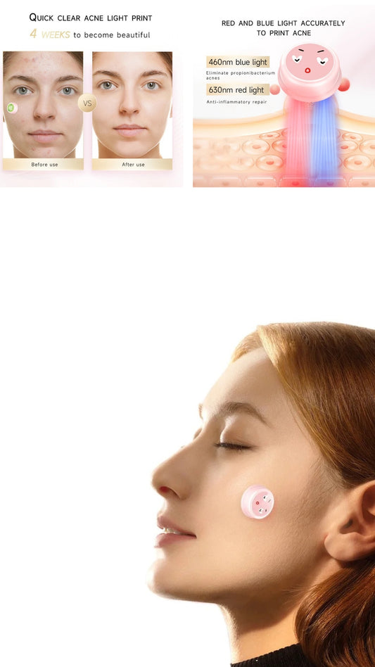 INNOVATIVE Small Button Electronic Acne Hydrocolloid Patch- 4 pieces