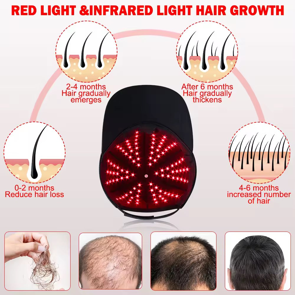ISP Mobile Laser Therapy Cap for Hair Regrowth, with 208 Red Light Lasers and 650mm wave length for Laser Hair Growth,Red Light Hair Growth Hat