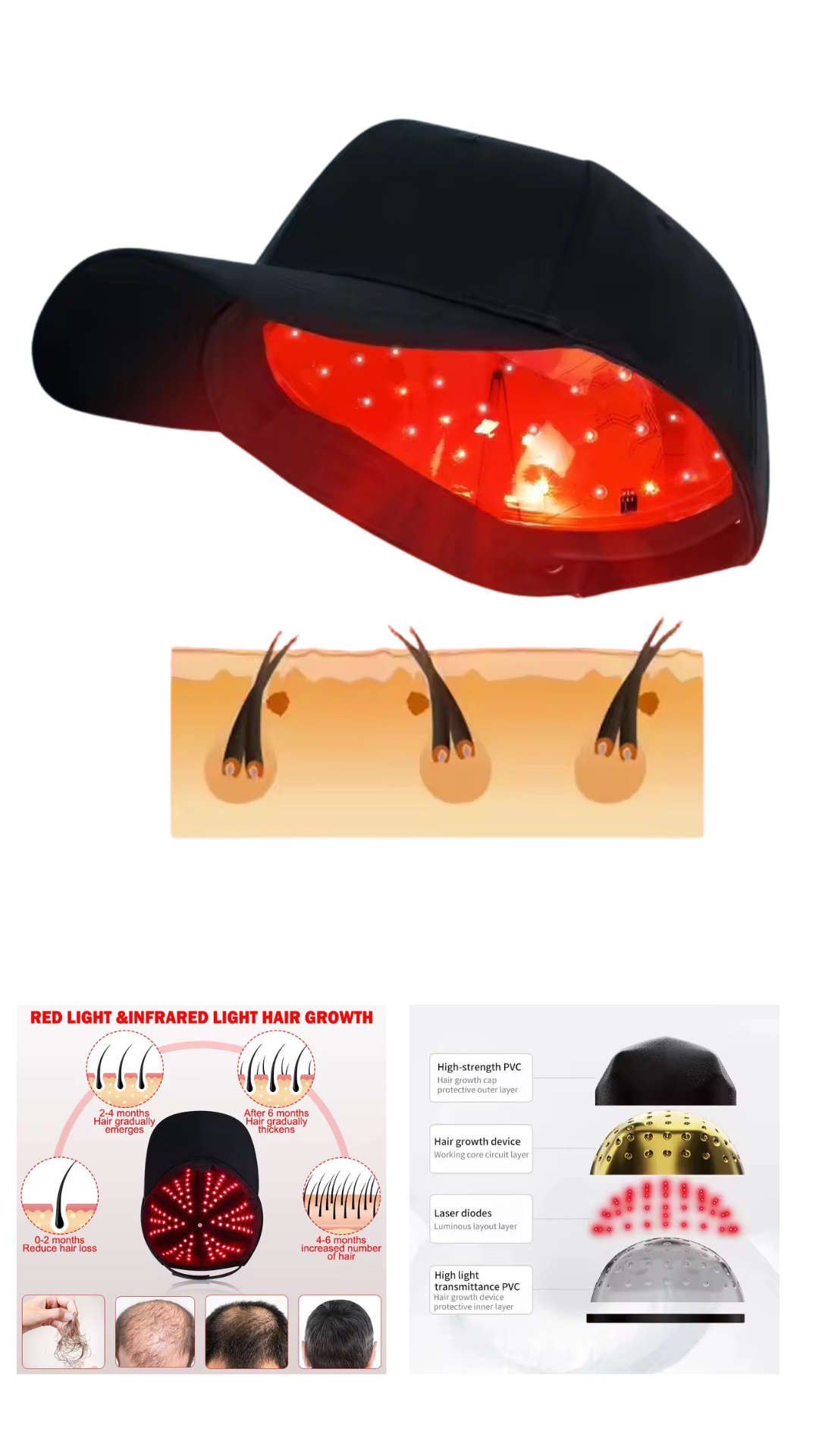 ISP Mobile Laser Therapy Cap for Hair Regrowth, with 208 Red Light Lasers and 650mm wave length for Laser Hair Growth,Red Light Hair Growth Hat