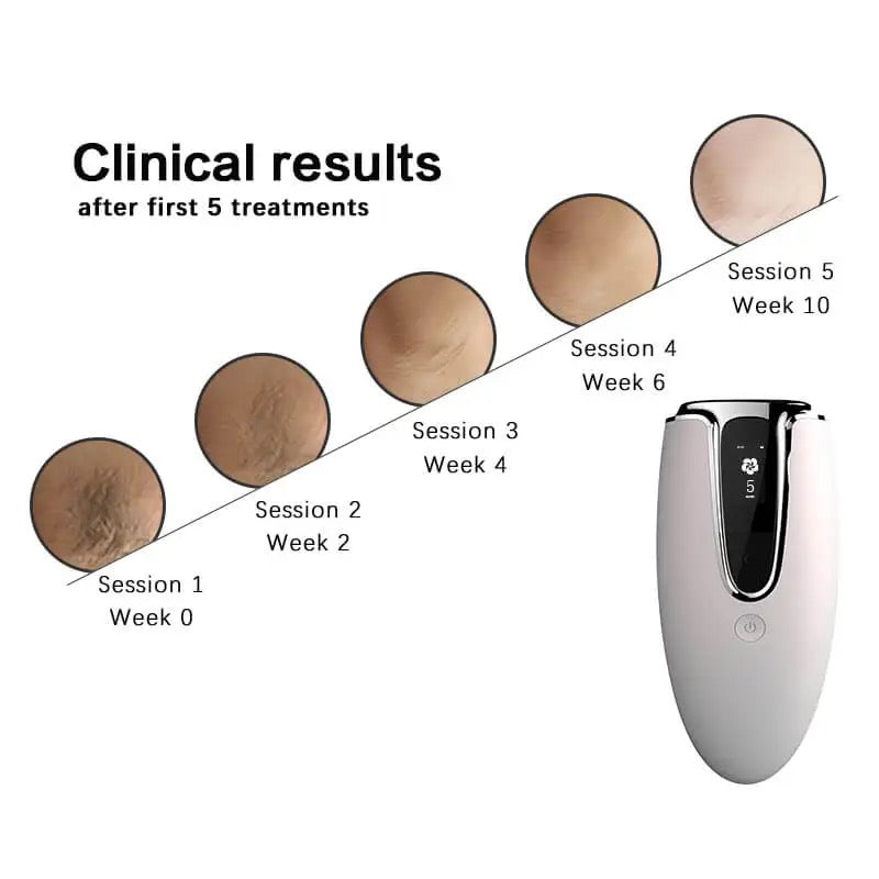 INNOVATIVE Long-lasting Laser Hair Removal Device for Women & Men, Skin i·Expert, at Home Hair Removal, , 2in1 IPL Laser Hair Removal & Skin Rejuvenation Handset with Goggles & Shaving stick for Clinical Results in 10 Weeks